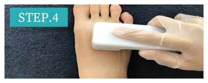 足の指脱毛Step4