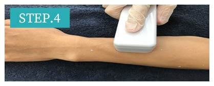 ひじ下脱毛Step4