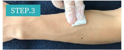 ひじ上脱毛Step3