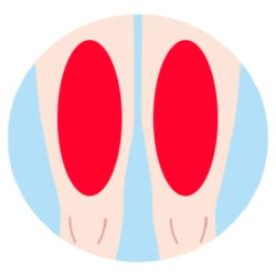 ひざ上(太もも)