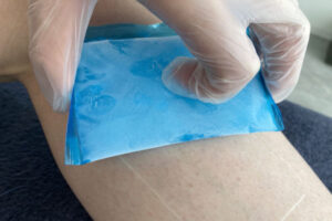 脱毛の痛みを最小限に抑える取り組み